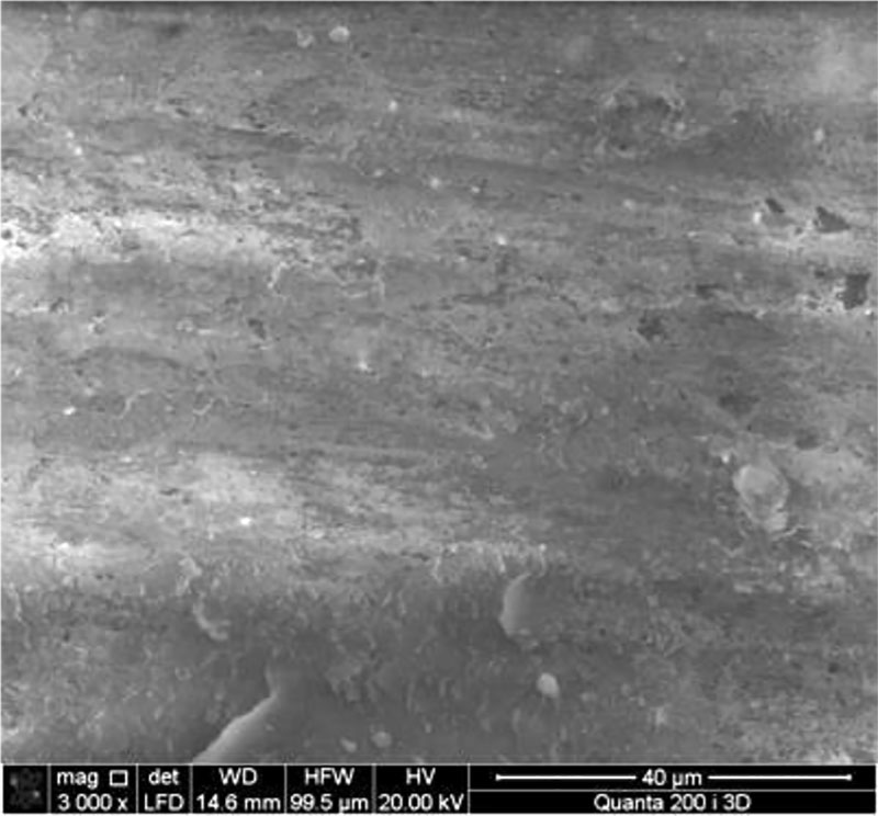 Figure 2 - Microstructure of an intact tooth, enamel prisms, SEM, magnification 3000